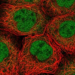 BBX Antibody, Novus Biologicals:Antibodies:Primary Antibodies